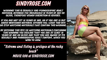 Extreme anal fisting &amp_ prolapse at the rocky beach Sindy Rose