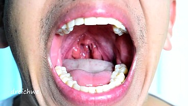 Deep and exciting uvula