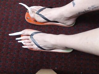 Very lengthy toenails in flipflops