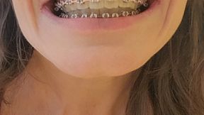 Cute Girl with Braces