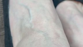 Heel and vein play