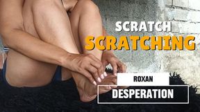 Desperately scratching his bare feet (3)