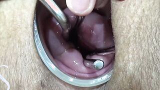 Maya Simons OPENING HER CERVIX (INSANE)