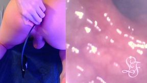 deepest anal exploration ever!