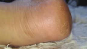 the imperfections of my feet
