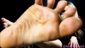 Accept You’re A Loser For Venom’s Feet