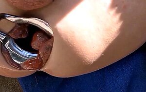 Extreme Anal Fisting for My Loose Sloppy Asshole