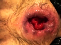 Anal orgasms from fisting