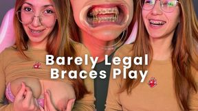 Barely Legal Braces Play
