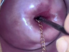 Extreme Asian Cervix Playing with Insertion Chain in Uterus