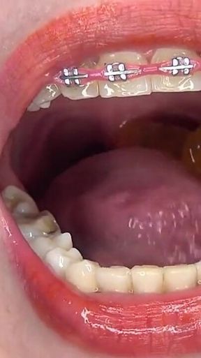 Swallowing Large Gummy Bears, Putting Them in the Vagina