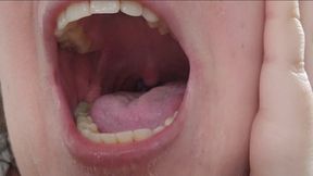 Close-Up of My Wet Throat and Open Mouth with Tongue and Yellow-Stained Teeth – Fetish for Spit, Gag Reflex and Throat Play