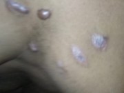 Moobs moobs