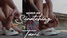 She is scratching her feet because it is itchy (4)