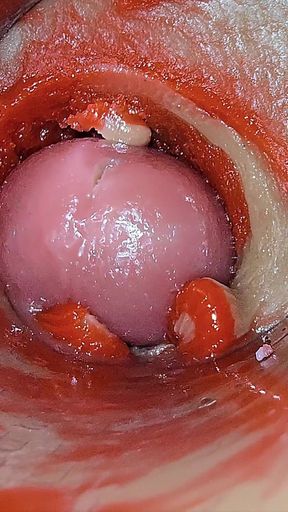 Camera Inside Deep Pussy Captures Overdose Ejaculation of Sperm Asmr