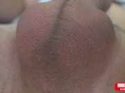 Scrotum with eggs moves fast