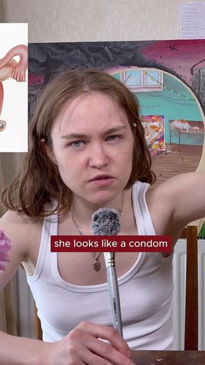 Contraception Cocs, Iuds, Suppositories, Implants, Etc