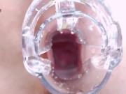 Extreme Pussy Close Up. Vaginal dilator
