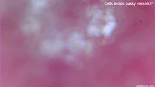 Cells moving inside pussy vessels!
