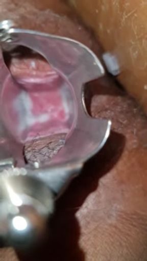 Sri Lanka girl Experiencing Pussy vaginal expansing toy