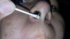 Nose Cleaning with cotton swab - nostril view