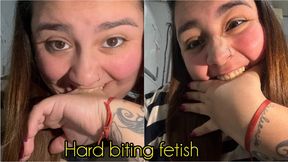 Hard biting fetish