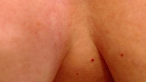 dawnskye1962 - update #4 - 1235 more belly button, under boob and armpits - may 01, 2025