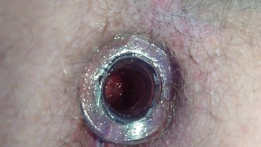 Der kleine Test mit dem Anal Tunnel
