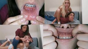 Stretching our lips CUSTOM