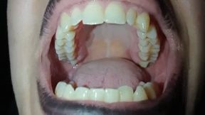 Roof of my big mouth