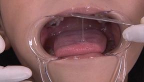 Japanese Milf Dentist Fuck – Juicy Ass Ridden by Horny Patient