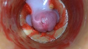 Camera Inside Deep Pussy Captures Very Huge Ejaculation of Sperm ASMR
