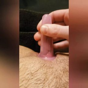 Clit Sucking Oral Sex Toy Homemade Sucks my Swollen Sensitive Clit Squirting Cum with Vibrator