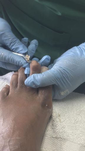 Cuticle Crust Cleanup