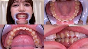 Mai Onodera - Watching Inside mouth of Japanese cute girl - 1080p